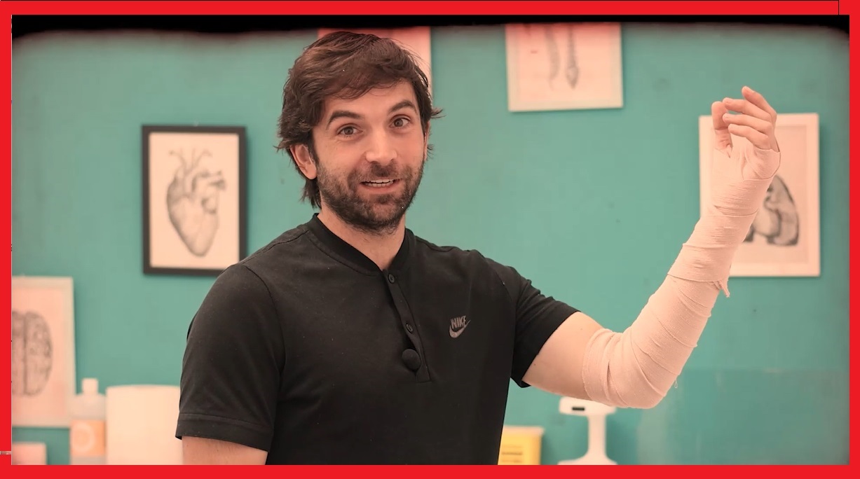 Distrófia Simpatico Refleja ó Sindrome Sudeck en mano y muñeca: 6 Ejercicios de Rehabilitacion